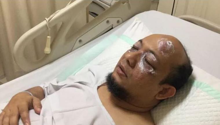 Novel Baswedan Disiram Air Keras Karena Tangani Kasus Korupsi E-KTP